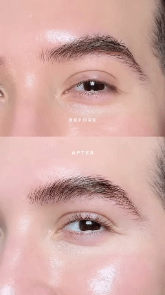 HyaluKiss – Hyaluronic Micro Needle Eye Patches