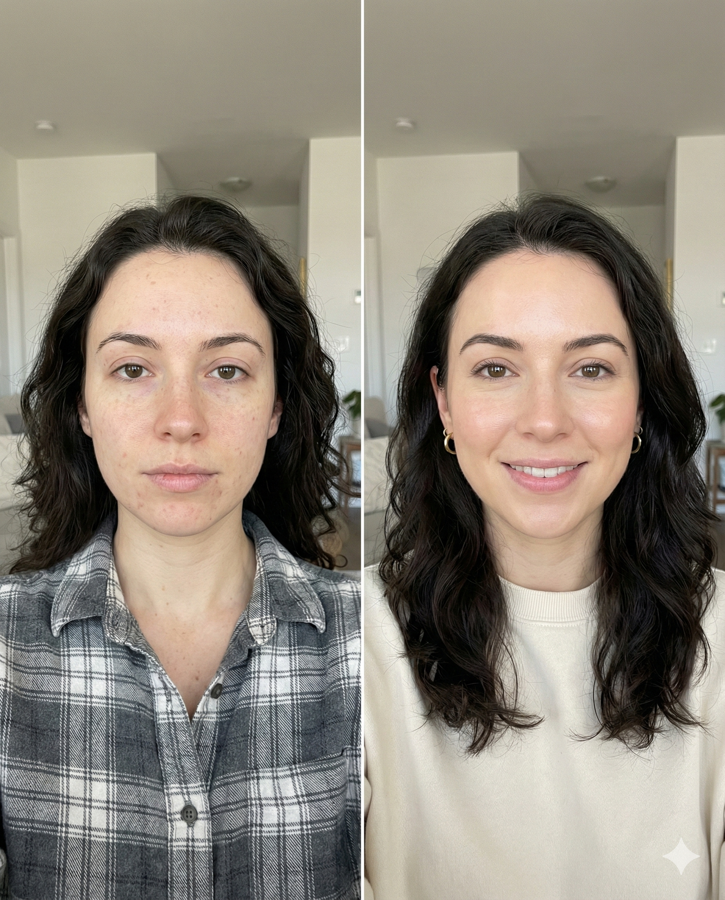 SeoulSparkle LED Rejuvenator