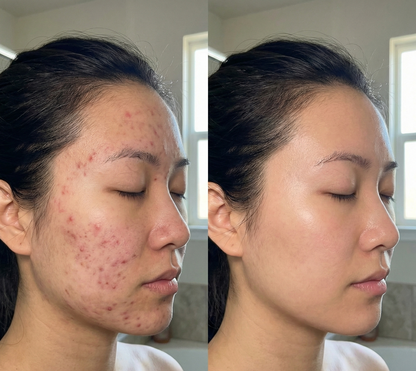 SeoulSparkle LED Rejuvenator